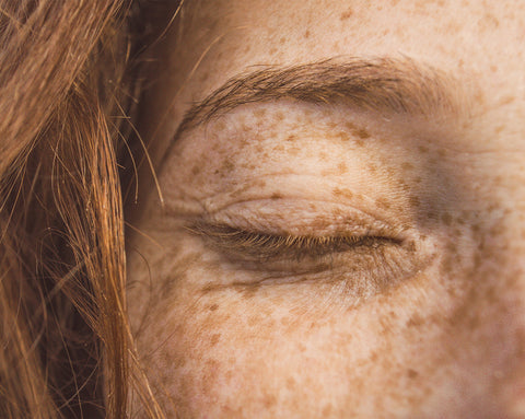 Close-up of a closed eye with freckles
