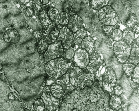 Electron microscope image of mitochondria in heart muscle, clearly showing the folded cristae of the inner membrane